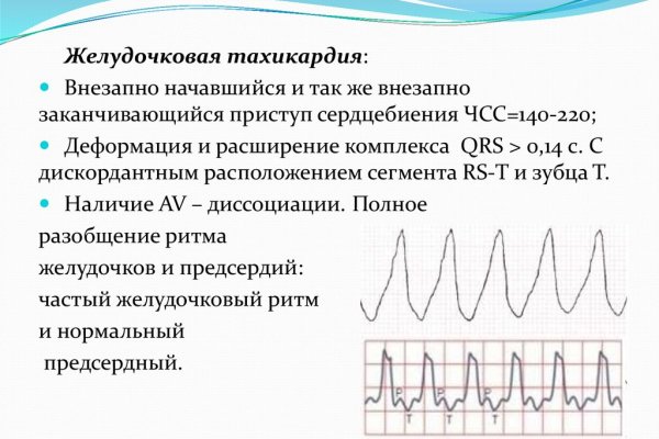 Как закинуть деньги на кракен